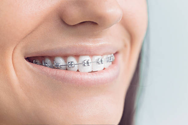 Best General Dentistry  in Mexico, IN